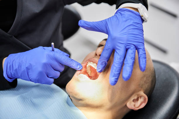 Best Emergency Gum Treatment in Kellogg, ID
